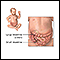 Intestinal obstruction (pediatric) - series