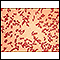 Red blood cells - sickle cells