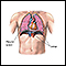 Pneumothorax - series - normal anatomy