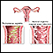Causes of vaginal itching