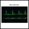 Bradycardia