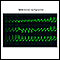 Ventricular tachycardia