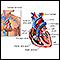 Swan Ganz catheterization