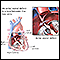 Atrial septal defect