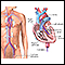 Left heart catheterization