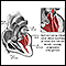 Mitral valve prolapse