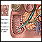 Biliary obstruction - series - Normal anatomy