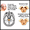 Substantia nigra and Parkinson disease