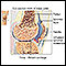 Rheumatoid arthritis