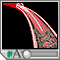 Balloon angioplasty - short segment