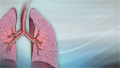 Chronic obstructive pulmonary disease