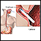 Esophageal manometry test