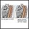 Changes in spine with age