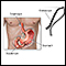 Gastric endoscopy