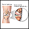 Medial collateral ligament