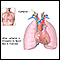 Cardiac catheterization