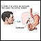 Cholecystogram