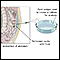 Peritoneal culture