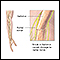 Radial nerve dysfunction