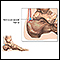 Retrocalcaneal bursitis